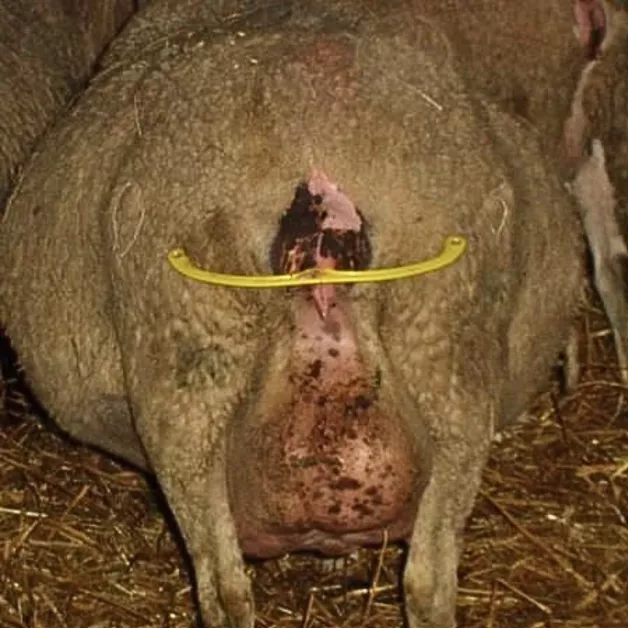 Oplossingen voor de preventie van een verzakking Oplossingen voor de preventie van een verzakking